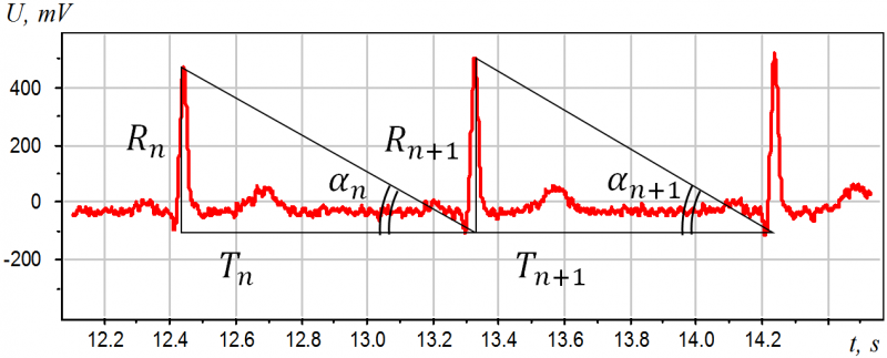 Изображение:ECG-TnRn.png